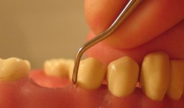 牙周病可能增加患乳腺癌的风险