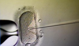 阅读阿拉巴马州最高法院对冷冻胚胎的裁决：试管婴儿是否在“受孕”时开始存在疑问