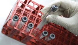 联合国执行委员会敦促马尼拉遏制艾滋病病例