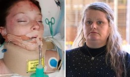 在车祸中严重受伤的昆士兰州女孩的妈妈说，不要让你的孩子骑电动滑板车