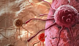 UPCI研究人员发现了阻止癌细胞生长的新技术