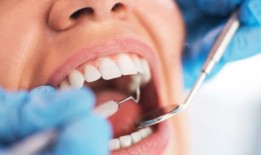 自2019年以来，超过3.5万名苏格兰人离开了NHS牙医，去了私人诊所