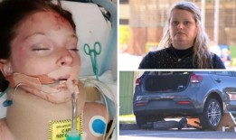 在车祸中严重受伤的昆士兰州女孩的妈妈说，不要让你的孩子骑电动滑板车