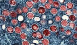 联合国卫生机构召集专家确定非洲麻疹爆发是否为全球紧急情况