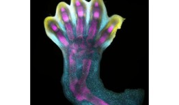 第一张人类肢体发育图揭示了意想不到的生长过程，并解释了出生时发现的综合症