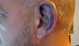 男子在社交媒体上为狗狗辩护几天后遭到XL Bully袭击｜英国新闻