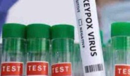 世界宣布进入公共卫生紧急状态，肯尼亚对麻疹病毒进行筛查