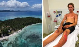 澳大利亚冲浪者詹森·柯比在印度尼西亚的一艘船爆炸中烧伤了13%的身体