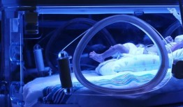 阿拉巴马州的婴儿死亡率处于历史最低水平，但阿拉巴马黑人的婴儿死亡率上升